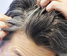 Graying of hair is the physiological manifestation of old age | Gray Hair  treatment at Valeda New Delhi
